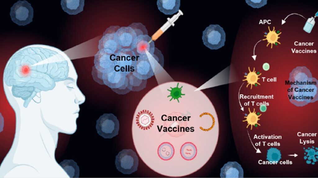 Cancer Vaccine Enteromix: 80% Success Breakthrough